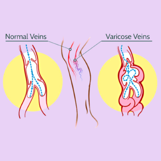14 Diosmin - Capillary & Vein Support