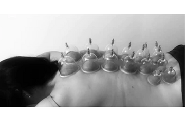 Cupping Therapy: At-Home Method for Diseases